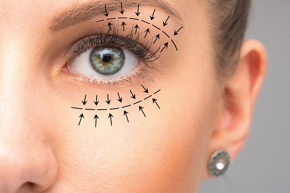 Eyelid Lift at Anatolian Health: Rejuvenate Your Appearance with Precision and Care