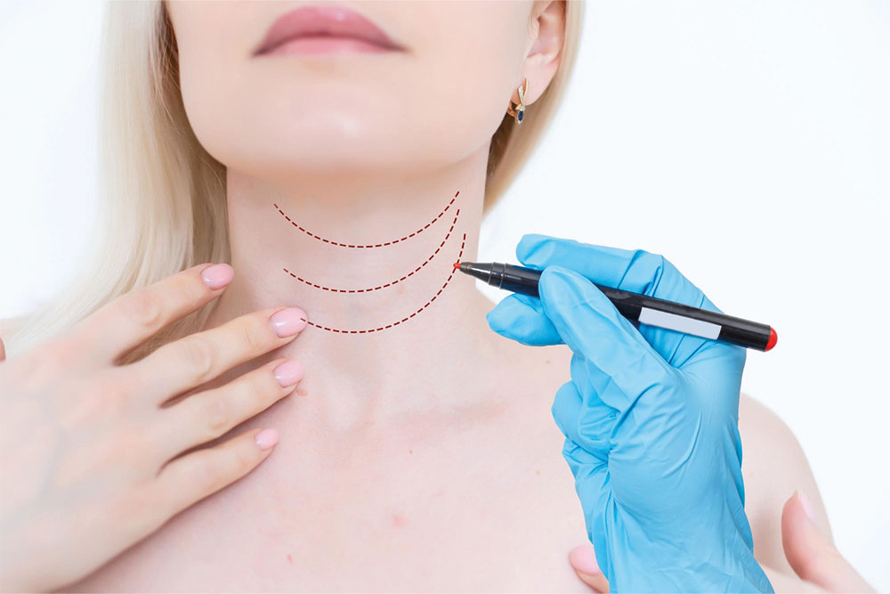 Neck Lift at Anatolian Health: Achieving Graceful Contours with Expert Care