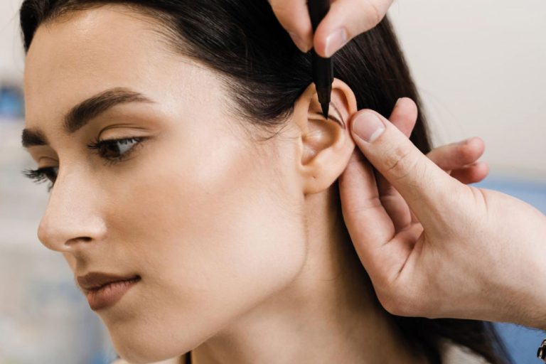 Otoplasty at Anatolian Health: Crafting Symmetry and Confidence with Expert Ear Surgery