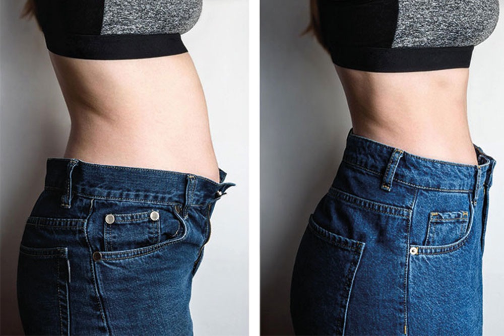 Tummy Tuck at Anatolian Health: Flatten and Tone Your Abdomen with Expert Care