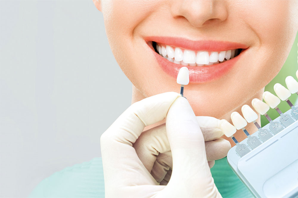 Veneers at Anatolian Health: Transform Your Smile with Elegance and Precision