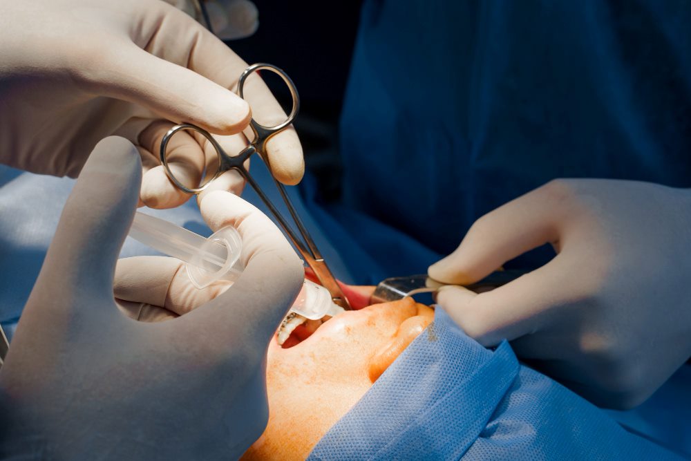 Oral Surgery at Anatolian Health: Expert Care for Complex Dental Needs