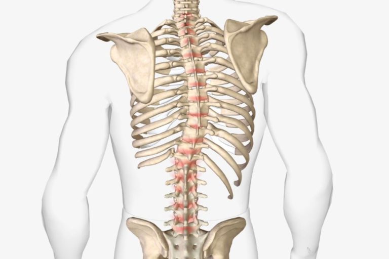 Scoliosis Surgery at Anatolian Health: Straightening the Path to a Healthy Spine