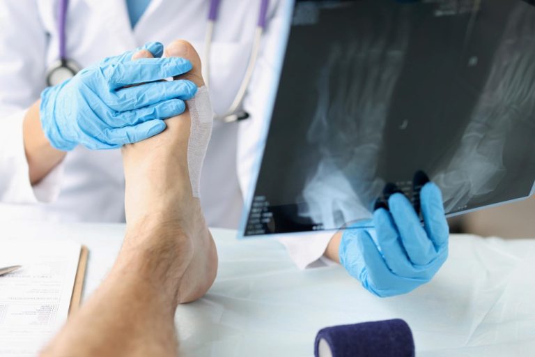 Bunion Surgery at Anatolian Health: A Step Towards Pain-Free Walking